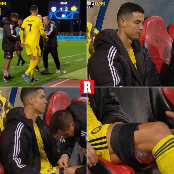 皇冠体育官网-美媒：C罗可能是腿筋受伤，若情况属实或影响他参加3月国家队比赛